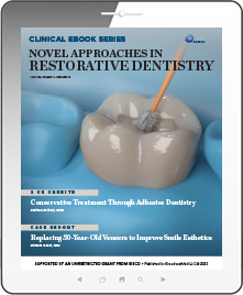 Novel Approaches in Restorative Dentistry eBook Thumbnail