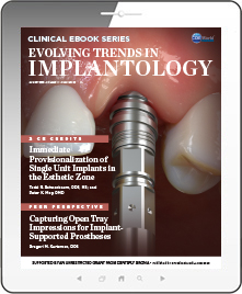 Evolving Trends in Implantology eBook Thumbnail
