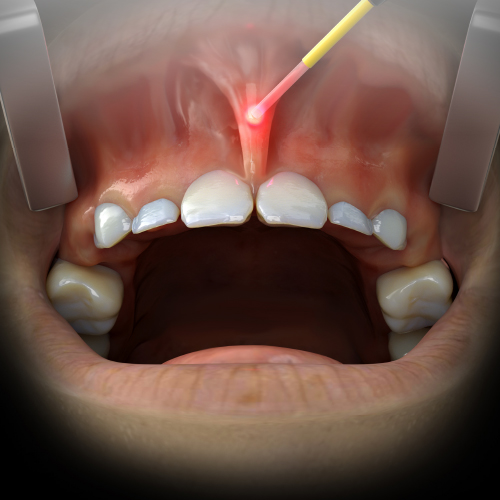 Periodontic Strategies eBook Thumbnail