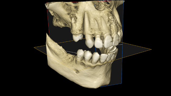 Emerging Trends in Digital Dentistry eBook Thumbnail