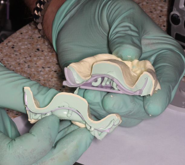 Fabricating Dentures with a Digital Denture System eBook Thumbnail