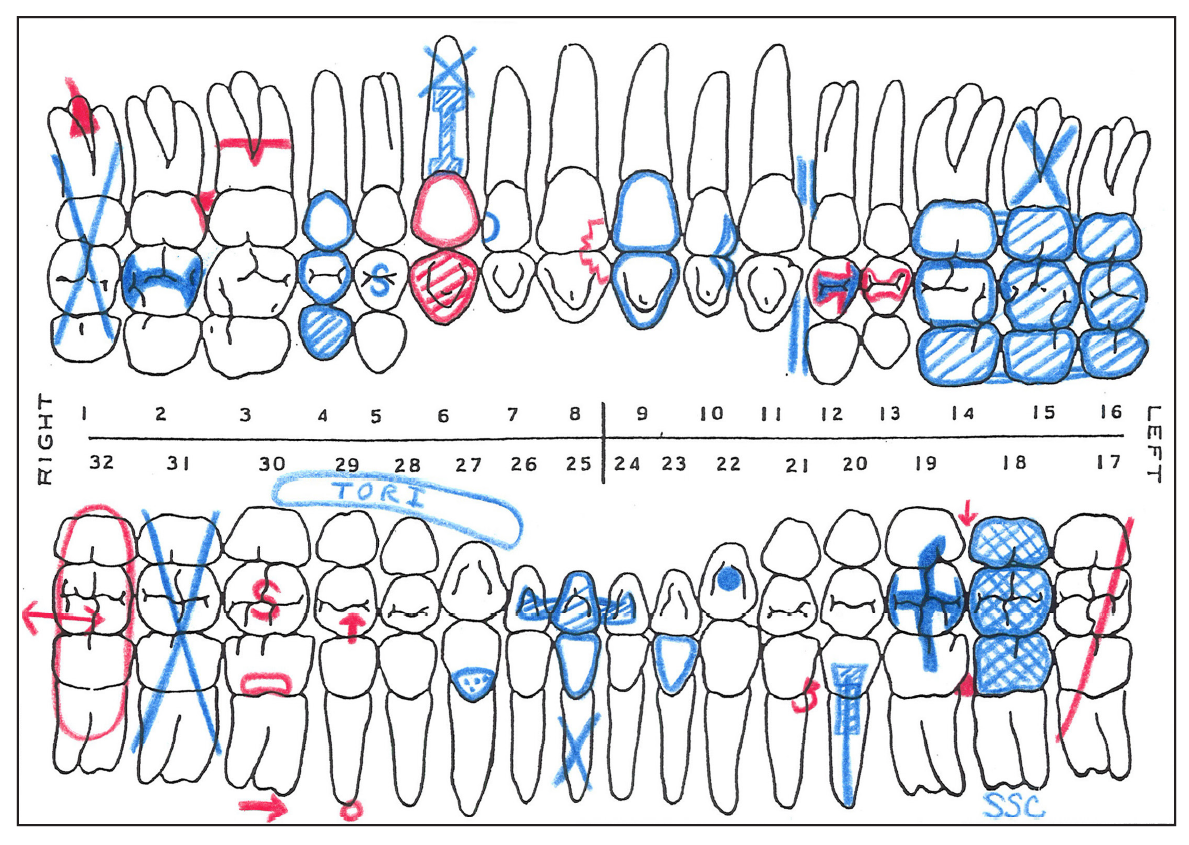 Dental Color Chart
