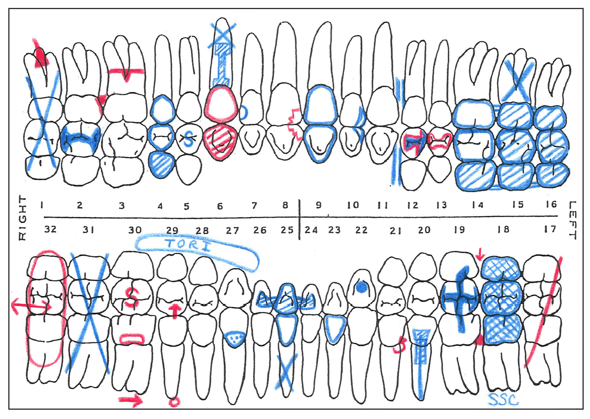 Dental Charting Practice Sheets