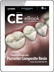 Simplified Predictable Posterior Composite Resins eBook Thumbnail