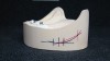Figure 9: A profile compass was used to locate the lowest point on the mandibular residual ridge and formulation of the posterior antagonist stop line.