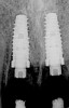 Figure 11  Periapical radiograph at the time of provisionalization. Note the wide peak of bone between implants Nos. 8 and 9.