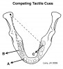 Figure 3  Working and nonworking side occlusal interferences create competing tactile sensory information.