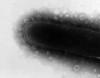 Figure 2  Transmission electron microscopic photograph of a negatively stained Phorphyromonas gingivalis featuring fimbriae and numerous surface blebs that likely contain endotoxin. Both fimbriae and endotoxin are potent antigens that solicit a host immune response. Original magnification of 35 000x.
