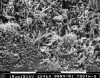 Figure 1  Scanning electron microscopic photograph of root associated dental biofilm (plaque). Bar = 10 micron at an original magnification of 2840x.