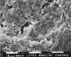 Figure 3  Scanning electron microscopic photograph of dental calculus characterized by a superficial layer of microbial biofilm. Bar = 10 micron at an original magnification of 1,770x.