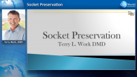 Socket Preservation Webinar Thumbnail