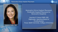 Restorative Driven Implant Placement: Predictable Surgical Placement for Restorative Simplicity Webinar Thumbnail