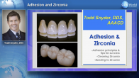 Adhesion and Zirconia Webinar Thumbnail
