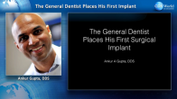 The General Dentist Places a First Implant Webinar Thumbnail