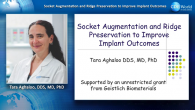Socket Augmentation and Ridge Preservation to Improve Implant Outcomes Webinar Thumbnail
