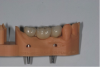 Fig 11 and Fig 12. Final restorations on SLA model.