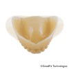 Fig 6. Flexible Good Fit PMMA tray.