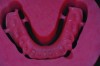 Fig 13. Detail of the digital denture base.
