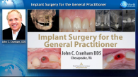 Implant Surgery for the General Practitioner Webinar Thumbnail
