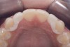 (24.) Occlusal view.