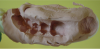 Figure 6: Same impression as in Figure 5 after a scalpel is used to remove the obstructive material, allowing the preoperative triple tray to reseat.