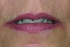 lips in repose;