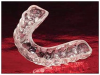 Figure 8. Night guard.
Courtesy of Glidewell Laboratories.