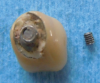 Fig 9. Cyclic fatigue can cause an abutment screw to break from the abutment, requiring removal from the implant.