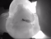 Fig 8. Case 2. NIR transillumination image shows darkness around the composite and in the cracked region, indicating caries in both areas.