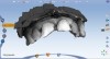 Figure 3. Minimum tooth preparation was required and digital models were made.
