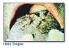 Fig 2. Hairy tongue.