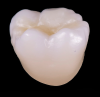 Fig 13. Monolithic molar crown fired at the ideal temperature determined to develop optimal translucency.