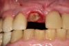 Fig 6. Image of the patient’s mature smile.