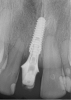 Fig 28. Postoperative radiograph at 16 weeks.