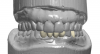 Fig 31. Digital diagnostic wax-up.