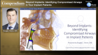 Beyond Implants: Identifying Compromised Airways in your Implant Patients Webinar Thumbnail