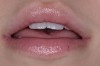Fig 13. Lips at repose.
