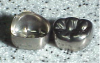 Figure 6. Preformed Metal Crowns (Courtesy of www.doctorspiller.com)