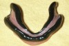 Fig 2. Mandibular custom tray border-molded with low-fusing compound (photograph courtesy of Carl Hansen, DDS).