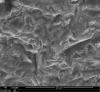 Fig 4. Surface texture on intaglio surface of zirconia crown following sandblasting.