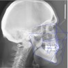 (5.) Postorthodontic cephalometric analysis.
