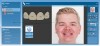 Fig 3. Overlay of proposed restorations on full-face photograph. (©2018 Planmeca. Used with permission.)