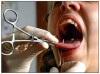 Figure 1. Tongue being pierced with needle.
