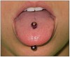 Figure 3. Pierced tongue with jewelry in place.