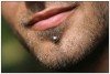 Figure 5. Labret piercing.