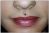 Figure 7. Medusa piercing.