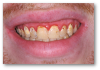 Fig 3. Red gingiva may be caused by a variety of factors.