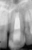 Fig 3. Postoperative radiograph.