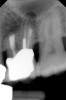 Fig 19. Postoperative radiograph.