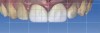(23.) Original scan superimposed over the proposals.